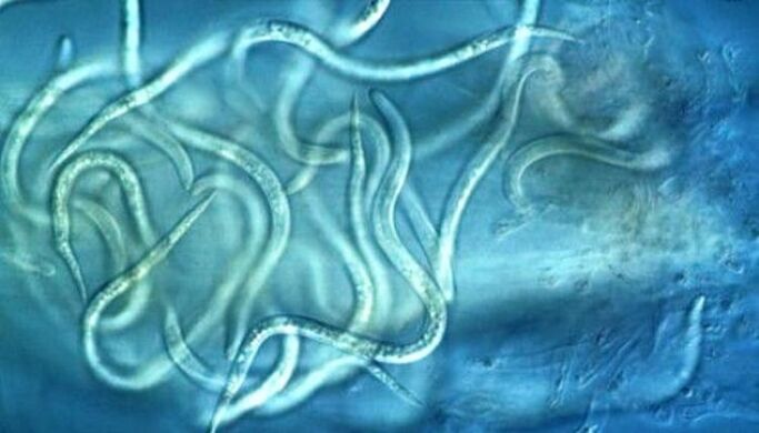 ako vyzerajú parazity nematódy v ľudskom tele