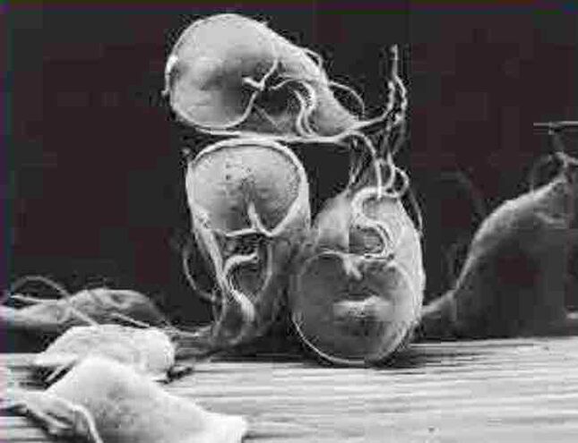 prvokový parazit Giardia